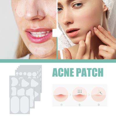 EELHOE  Acne Mask Patch Mild and Non-irritating Fade Acne Marks and Pimples Facial Repair Patch