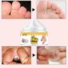 Chapped Hands and Feet Repair Cream, Moisturize, Nourish the Skin, and Leave the Skin Soft and Delicate