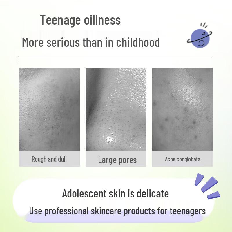 Aibowei Refreshing Oil Control 4-Piece Skincare Set