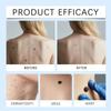 7 Day Skin Tag & Dark Spot Remover Pen Suitable for Beginners for At Home Daily Facial Skincare Use 1Pcs