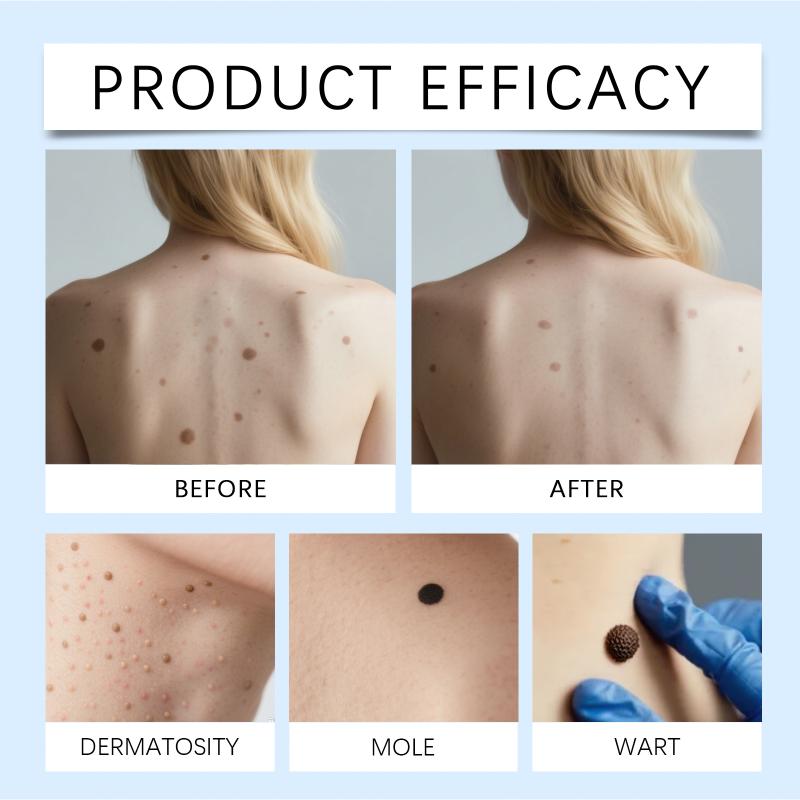 7 Day Skin Tag & Dark Spot Remover Pen Suitable for Beginners for At Home Daily Facial Skincare Use 1Pcs