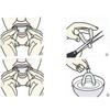 2-10pcs Silicone Mouth Guard Teeth Protector Anti Snoring Soft Guard Mouth Tray for Bruxism Grinding Teeth Whitening Protection 3
