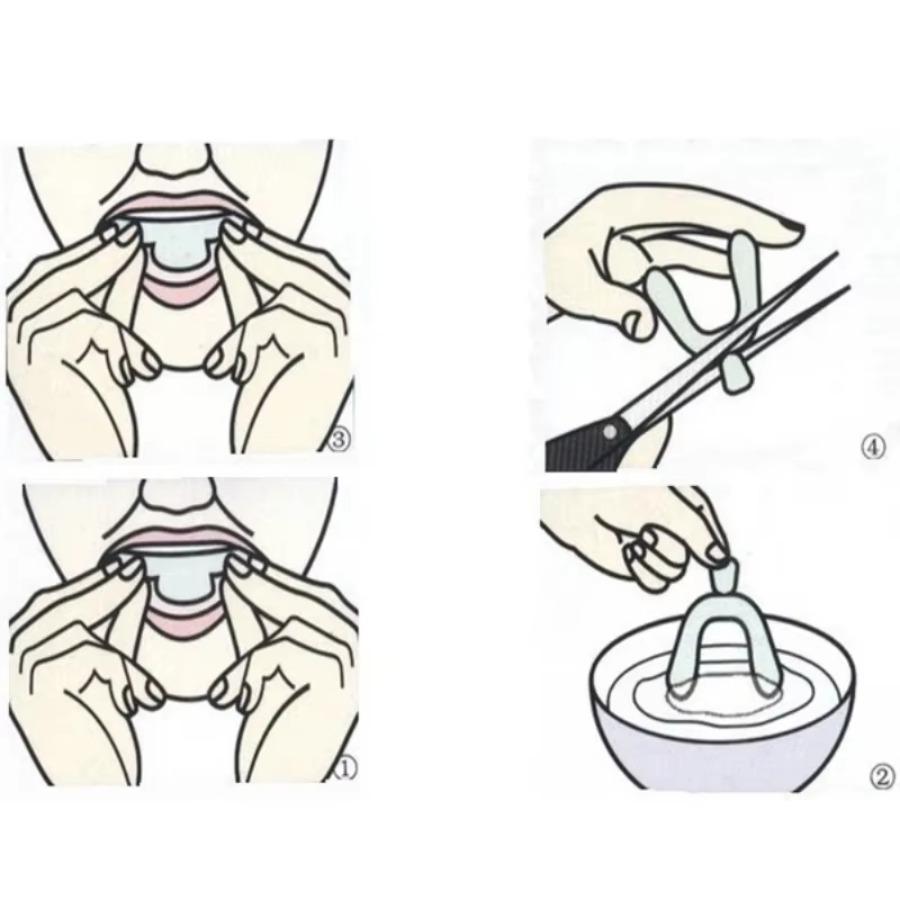 2-10pcs Silicone Mouth Guard Teeth Protector Anti Snoring Soft Guard Mouth Tray for Bruxism Grinding Teeth Whitening Protection 3