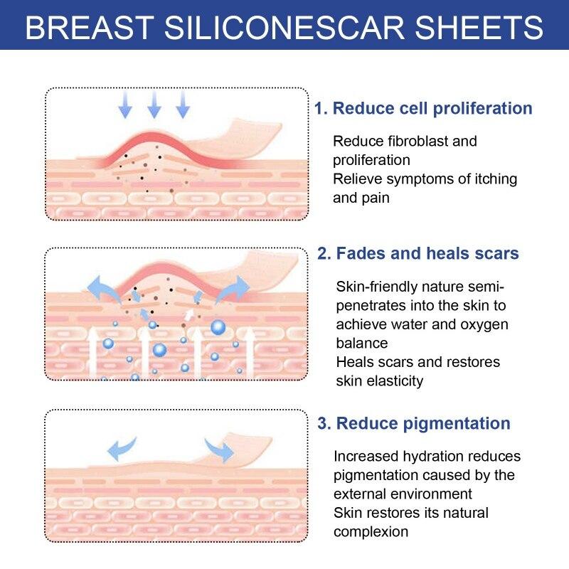 4 par bryst silikon arr ark Augmentation Surgery Supplies Bryst Arr Strips Deksel Flatt Fade High-End Medical-Grade