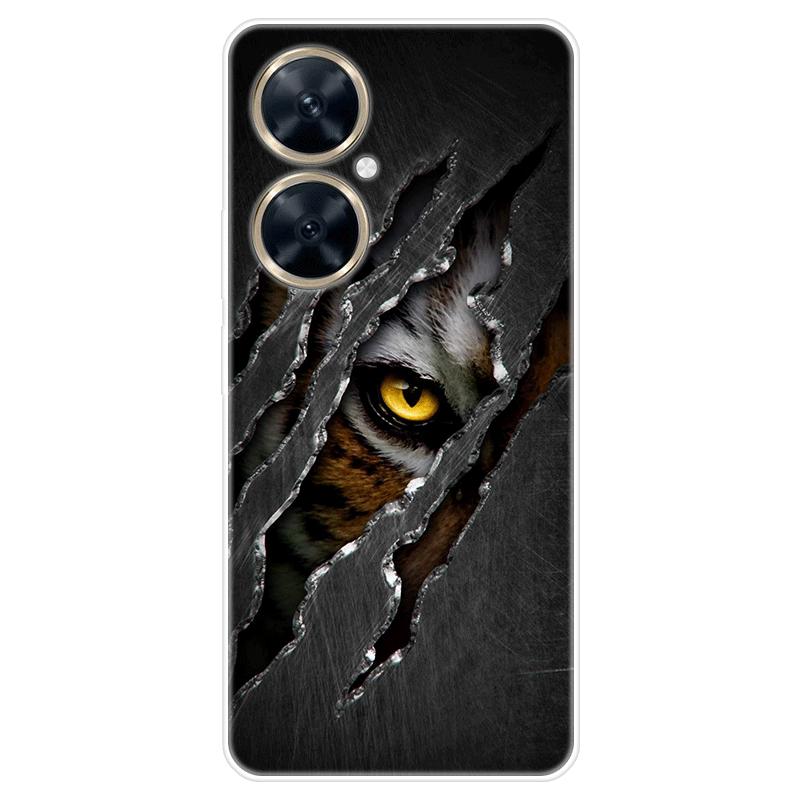 Für Huawei nova 11i nova11i Fall Weiche Silikon Zurück Abdeckung Cartoon Telefon Fall Diversifizierung