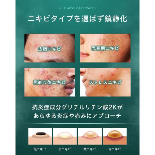 NILE Acne Lotion Men's Women's Quasi-drugs