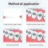 Dental Floss Threader Dental Traction Line Oral Cleaning For Crown Brace Bridge Implant Hoop Threading Braces Steel Traction
