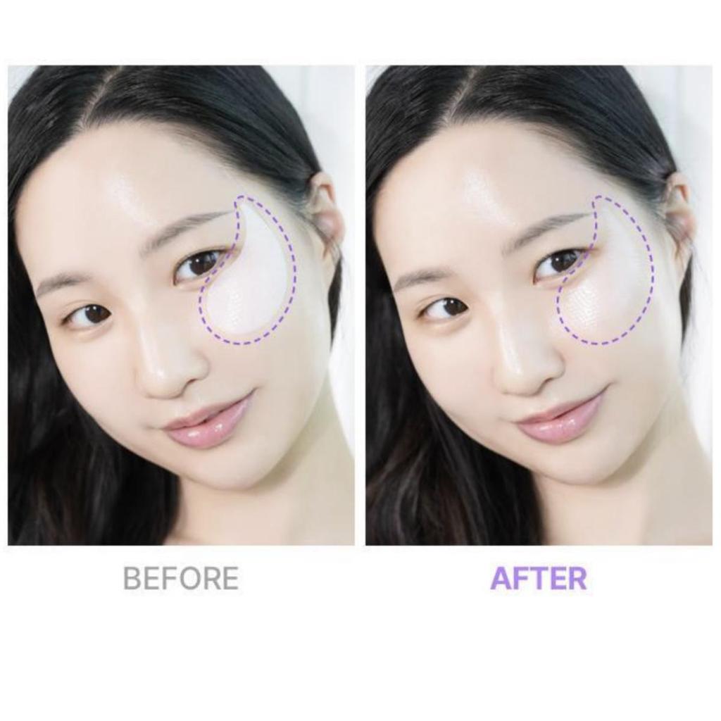 Bio Heal Boh Probioderm Collagen Remodeling Eye Patch 60ea