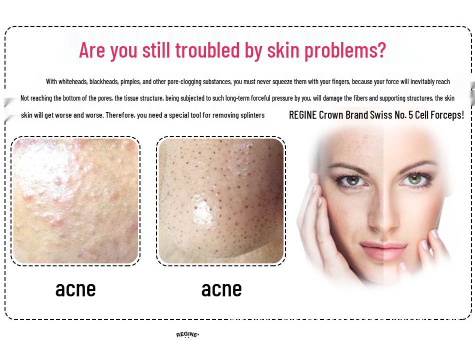 Christina Cell Acne Removal Needle No. 5 - Ultra Fine Blackhead & Pimple Clip