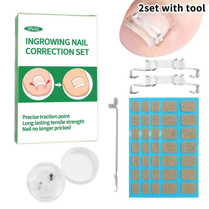 Set Tool 1/2 Ingrown Toenail Corrector Pedicure Recover Embed Treatment Professional Foot Care Correction