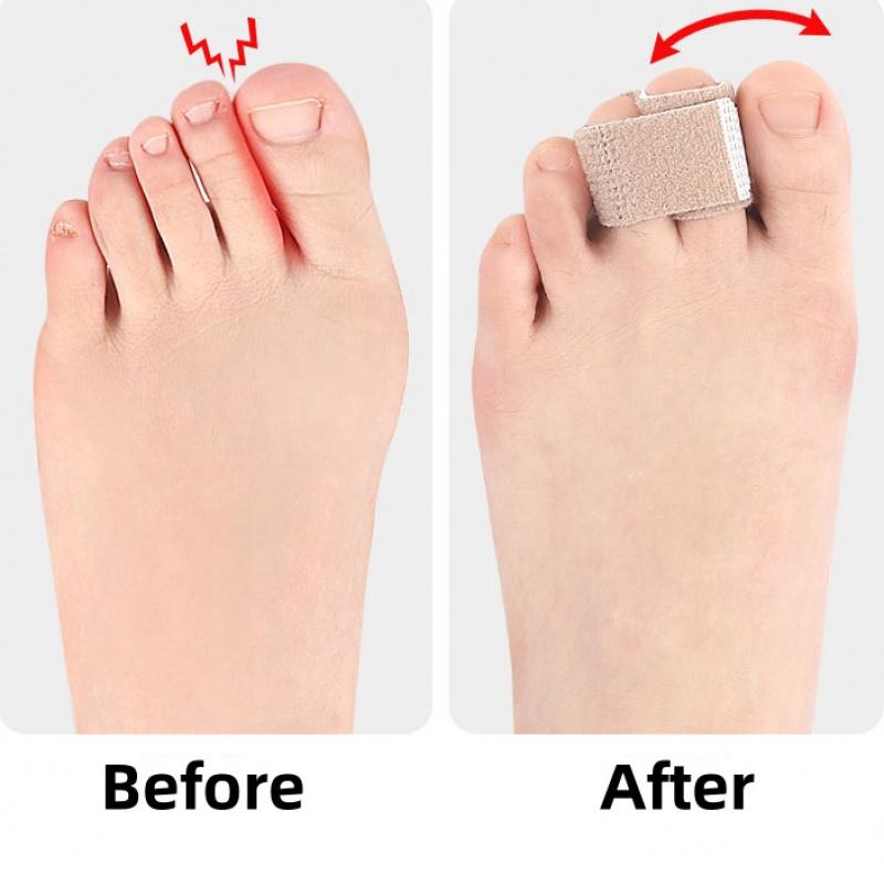 1pc/2pcsToe Separator Hallux Valgus Corrector Day and Night Use for Men and Women Elastic Band Middle Toe Stretcher