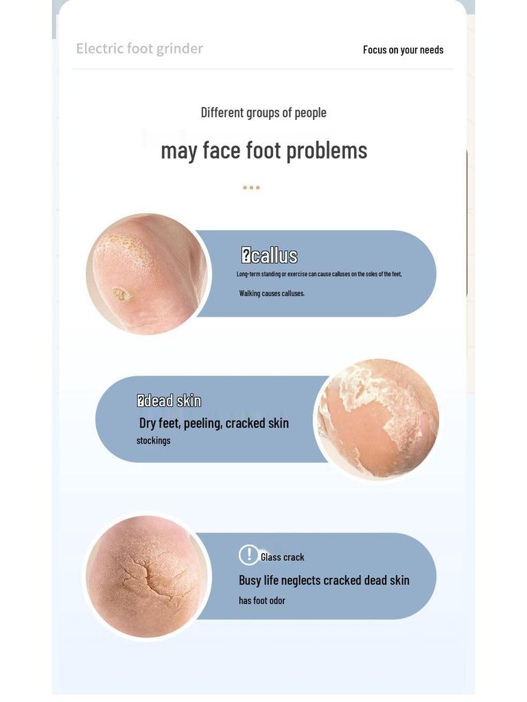 Portable Electric Waterproof Foot File & Callus Remover with LCD Display for Home Pedicures