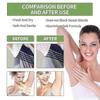 Deodorant Body Odor Dew Underarm Cleansing Deodorant Deodorant Antiperspirant Lotion Long-lasting Fragrance Mild And Non-irrita