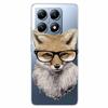 For Xiaomi 14T Case Transparent Cute Soft Silicone TPU Coque for Xiaomi 14t Pro Phone Cover Clear Capa Mi14T 14 t 14tPro Shells