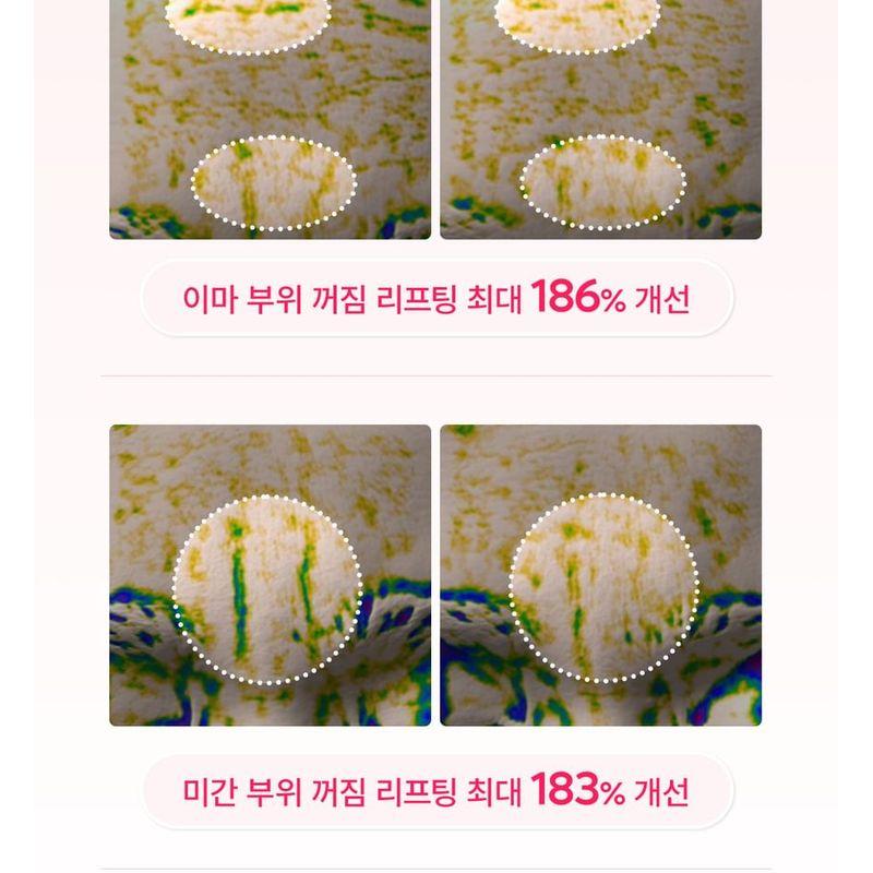 Dr.Melaxin - Cemenrete Cyano Pink Spicule Cream