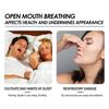 Stop Snoring and Teeth Grinding, Sleep Better with Anti-Noise Mouthguard ,1pcs
