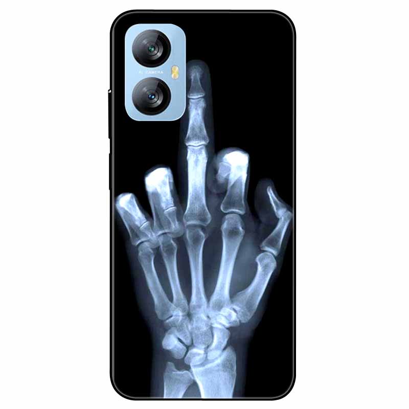 Für Blackview A52 Pro Hülle Handyhülle Stoßfeste Schwarz lackierte TPU Hülle für Blackview A52 Pro Silikon Weicher Bumper A52Pro Süß