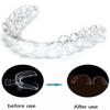 Tăviță Profesională pentru Albirea Dinților Protecție Dinte Gingie Produse Dentare Aliniator Denti Teeth Whitening Kit Instrumente Dentare Dente