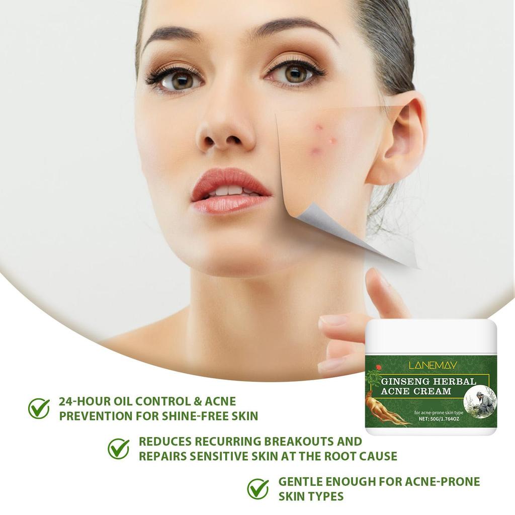 Ginseng Herbal Acne Cream- 24-Hour Long-Lasting Oil Control and Anti-Pimple Protection for Sensitive Skin, 50g