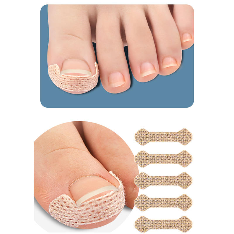 10Pcs Breathable Ingrown Toenail Correction Patches Stickers Self-Adhesive Nail Straightener Strips for Toenail Care