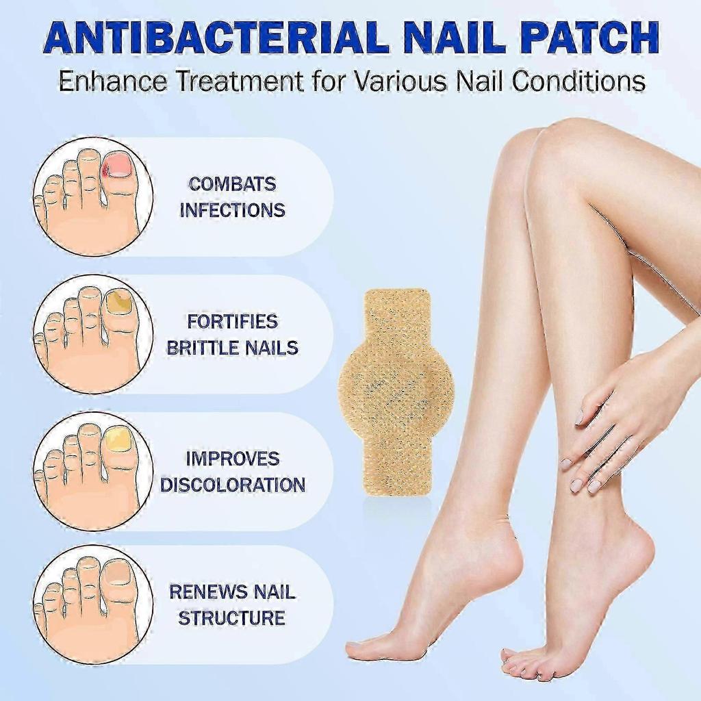 Oenail Fungus Patch Waterproof Nail Repair Patches Nail Ingrown Correction Stickers For Discolored Or Damaged Nails Treatment