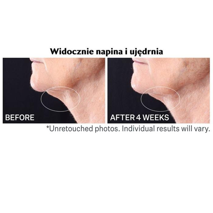 Strivectin Serum Napinające Z Rollerem Do Szyi