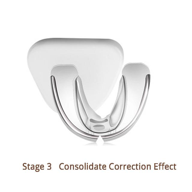 Zahnspangen Kieferorthopädie Retainer Zahnaufhellung Glätten 3 Stufen körperliche Korrektur Erwachsene