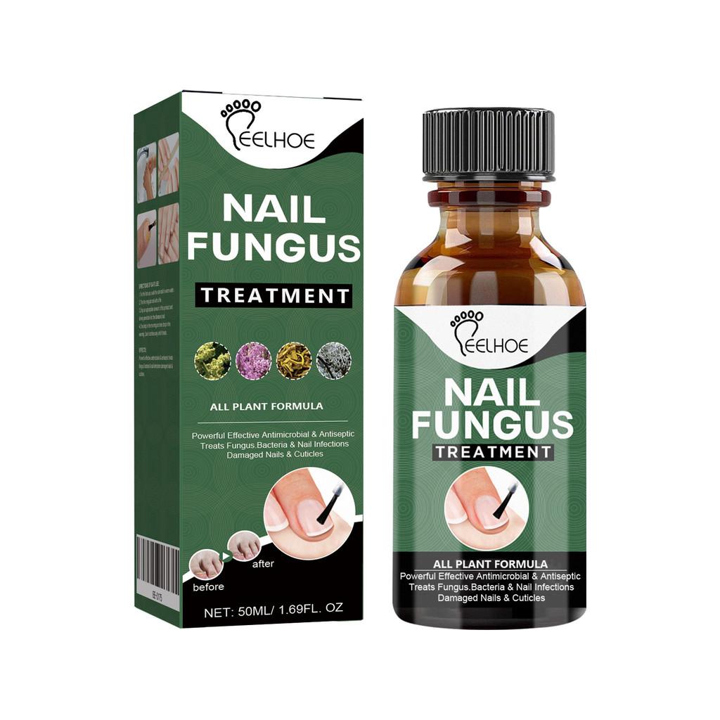 Eelhoe Nail Repair Liquid For Thick Toenails And Fungal Infections 50ml Ideal For Healthier Feet