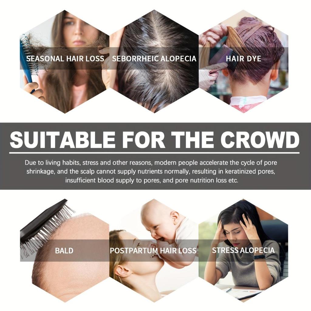 Hair Thickness Essence Scalp Massage Care Moisturizing Hair Roots Smooth Thick Hair Hair Care Essence