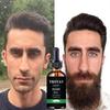 Beard Oil Hair Oil for Fast Hair Growth  Beard  Hair Growth