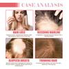 Hair Care Essential Oil, Moisturizes Hair Roots, Thickens & Strengthens Hair, Improves Dry & Frizzy Hair, Effective Hair Protection & Stabilization