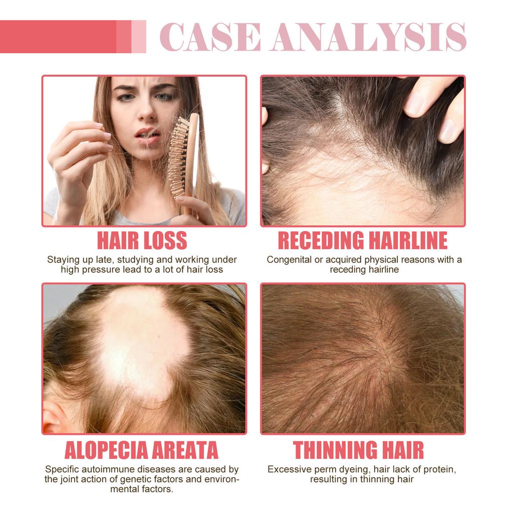 Hair Care Essential Oil, Moisturizes Hair Roots, Thickens & Strengthens Hair, Improves Dry & Frizzy Hair, Effective Hair Protection & Stabilization