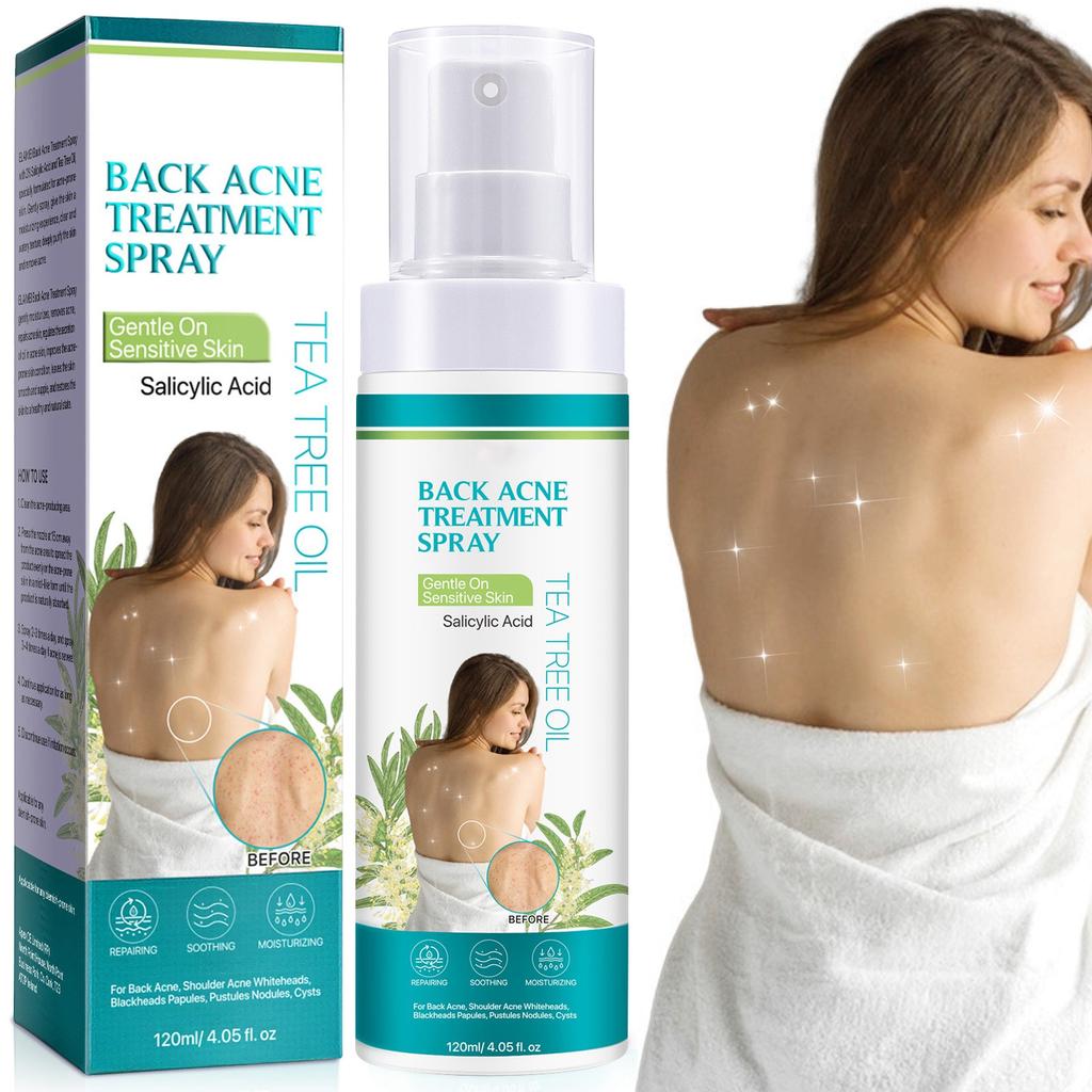 Back Acne Spray With Acne-removing Ingredients, Natural Back Acne Spray To Clear Back And Body Acne,120ML