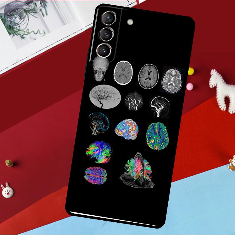 Medical Human Organs Brain Funda For Samsung Galaxy S26 S25 S24 S21 S22 S23 Ultra S10 Plus S20 FE S25 FE Phone Case