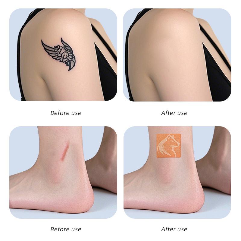 Abdecken Narbe Unsichtbare Tattoo-Aufkleber Wasserdicht Ultradünn Makel Muttermal Körper Arm Temporäre Abdeckbänder Für Jeden Hauttyp