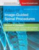 Atlas of Image-Guided Spinal Procedures, 2e (English, Hardcover)