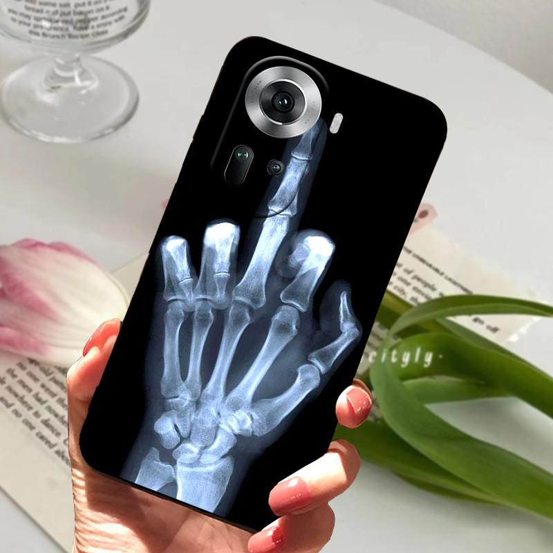 Para Capa Oppo Reno 11 5G animal Silicone TPU Macio Capas Traseiras Para Oppo Reno 11 Pro 5G / Reno 11F 5G Capa Protetora Desenho Animado Capa