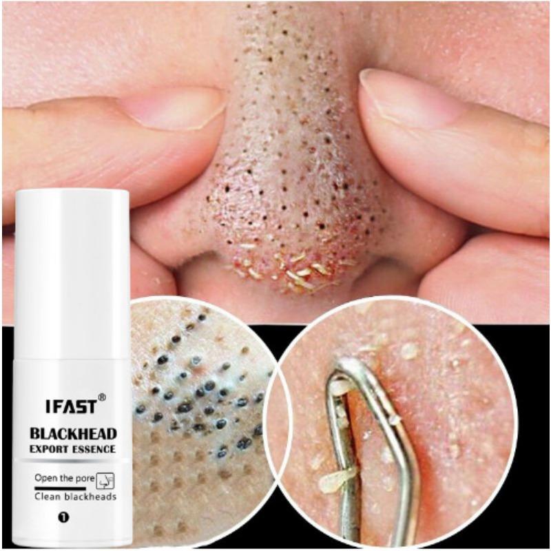 Blackhead Lead Liquid Deep Cleansing and Shrinking Pores, Delicate and Soft To Remove Blackhead Nasal Membrane