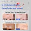 HIEUAILR Whitening & Acne Control Facial Cleanser with Niacinamide