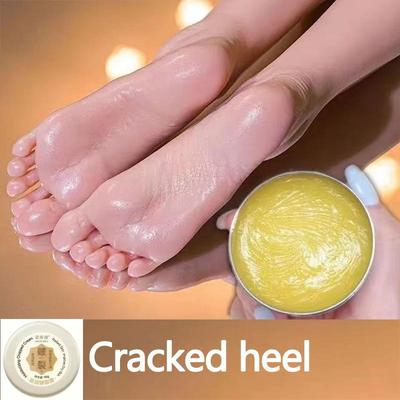 Anti Crepa Crema Per I Piedi Crema di Riparazione Della Pelle Screpolata Secchezza Tallone Incrinato Peeling Riparazione Maschera Per Il Piede Cibo Ammorbidire Idratante Lotin