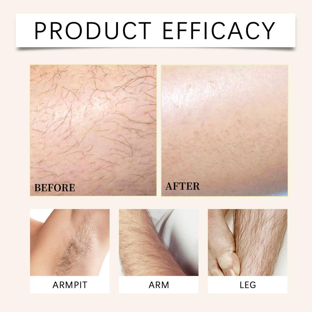 Hair Removal Kit, Facial Hair Removal For Women Body Hair Removal Depilatory For Face, Arm, Leg And Bikini Hair Remover Balm Hair Scraper 100g