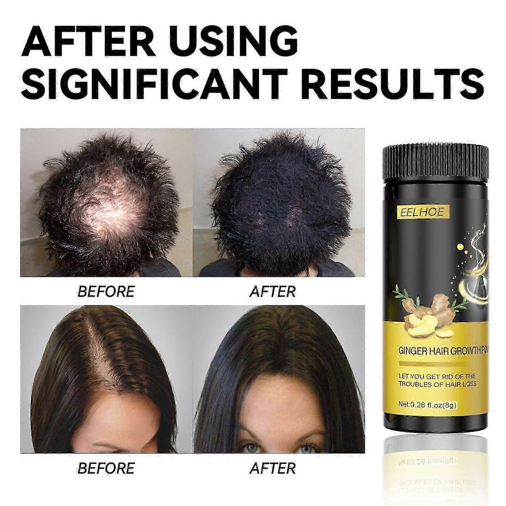 Ginger Hair Care Powder - Natural Moisturizing & Strengthening Treatment for Thicker, Darker Hair | Stimulates Hair Growth, Reduces Hair Loss, 8g Trav