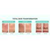 BRING GREEN - Zink Teca Unreinheiten Serum