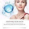 Acne Cream Dot Cream Acne Scar Skin Cream For Natural Gel For The Face  50G