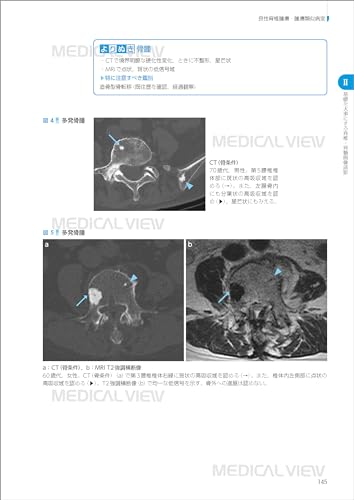 First of All, Let's Start with the Basics: Spinal Imaging Diagnosis