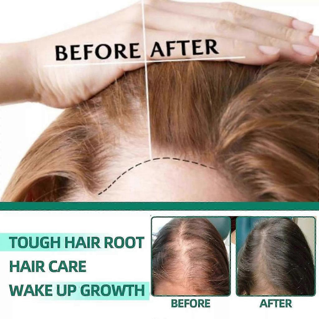 Yaopin Anti-Hair Loss & Hair Growth Solution Loss Care Liquid Conditioner Serum