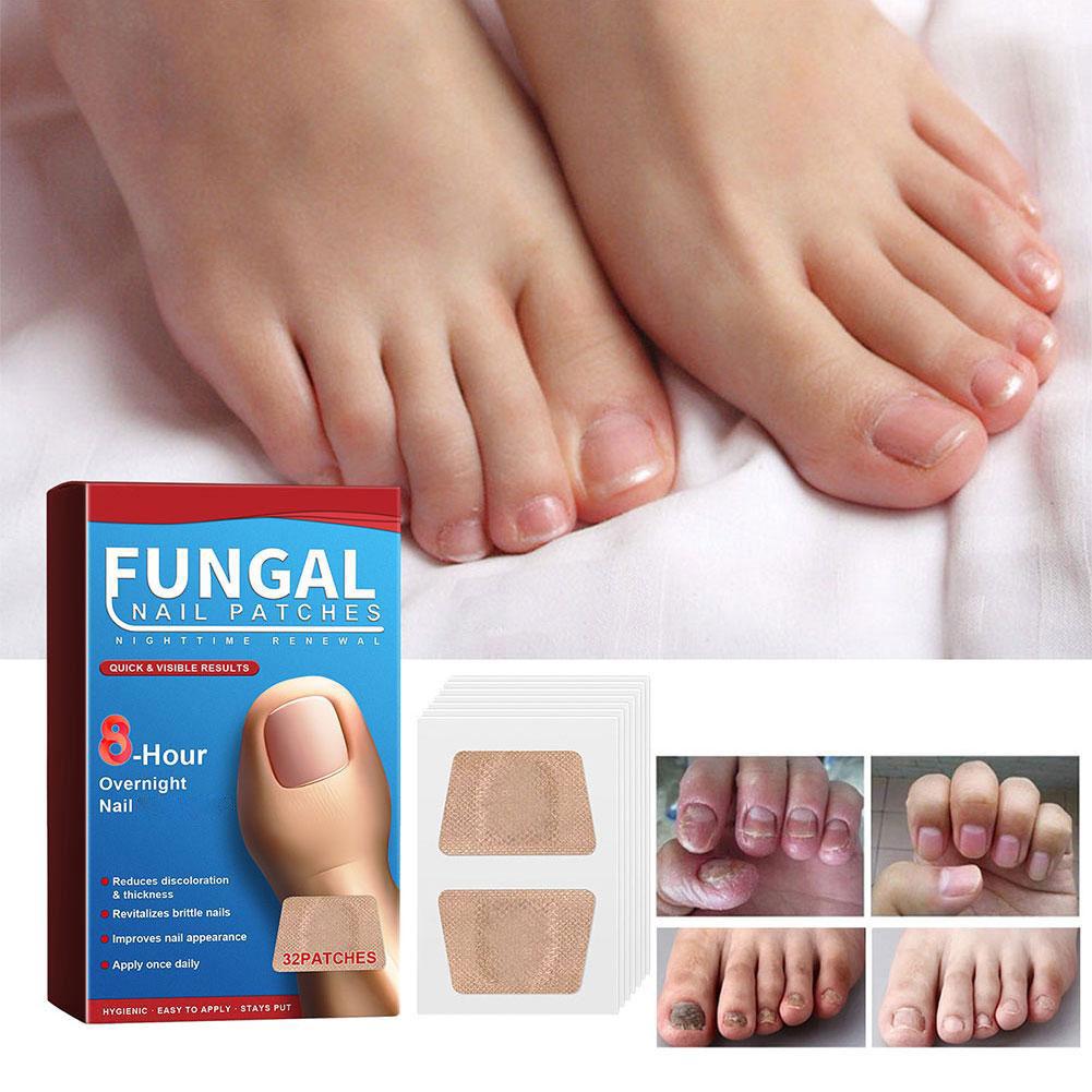 32 graue Nagelpilzpflaster zur Behandlung von Nagelpilzinfektionen, Handnagelreparaturaufkleber für eingewachsene Zehennägel
