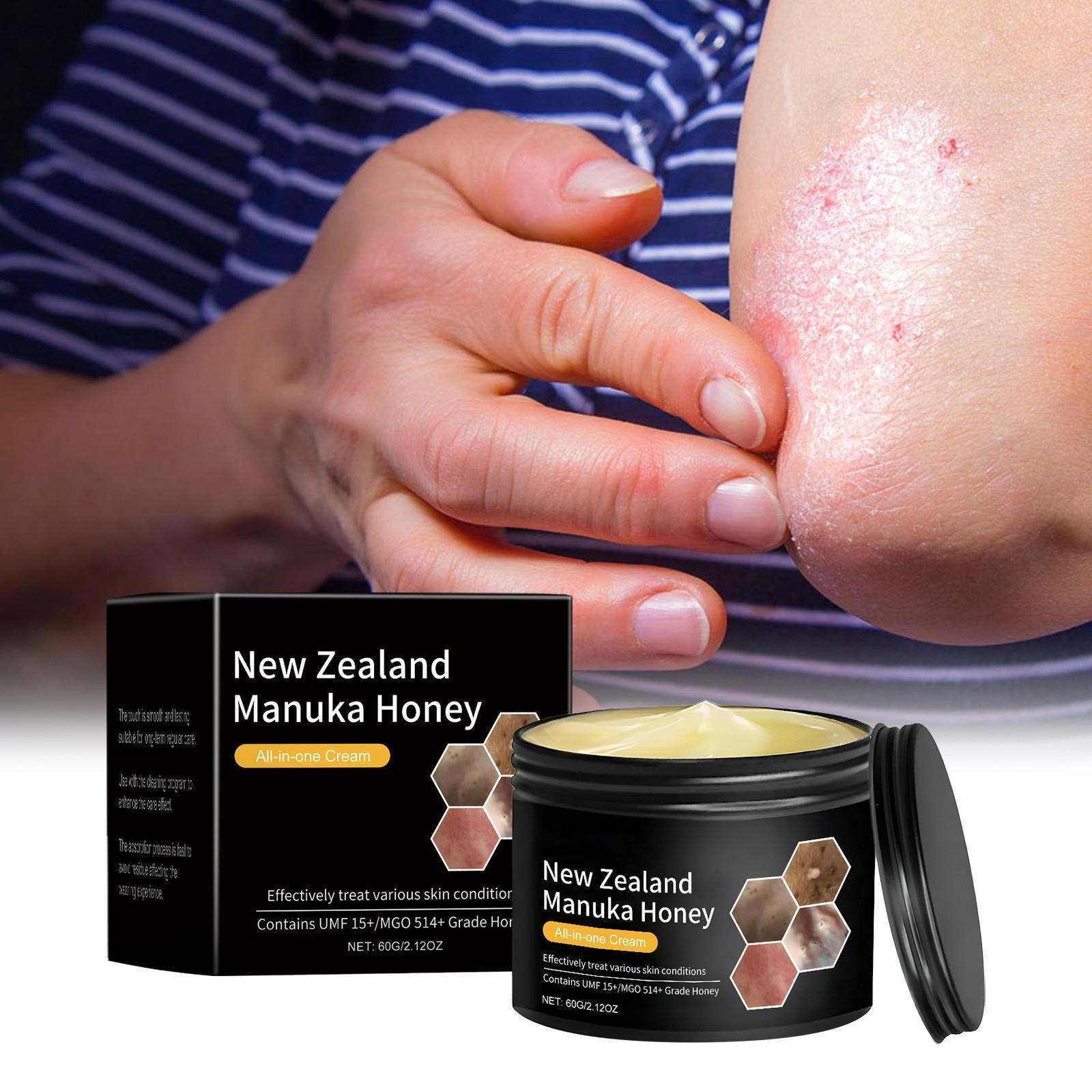 

Крем от экземы, Многофункциональный уходовый крем, Питает кожу и успокаивает сухость. Подходит для лица и тела One Size белый