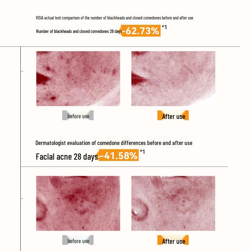 Yu Mei Jing Oil Control Purifying Dual-Tube Facial Cleanser