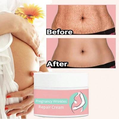 Pregnancy Firming Skin Repairing Cream After Pregnancy